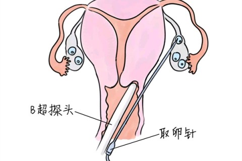 http://wuxi.vdtfzz.com/post/205.html|无锡供卵助孕