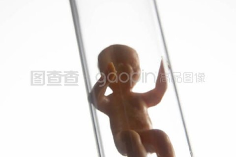 http://wuxi.vdtfzz.com/post/197.html|无锡试管助孕